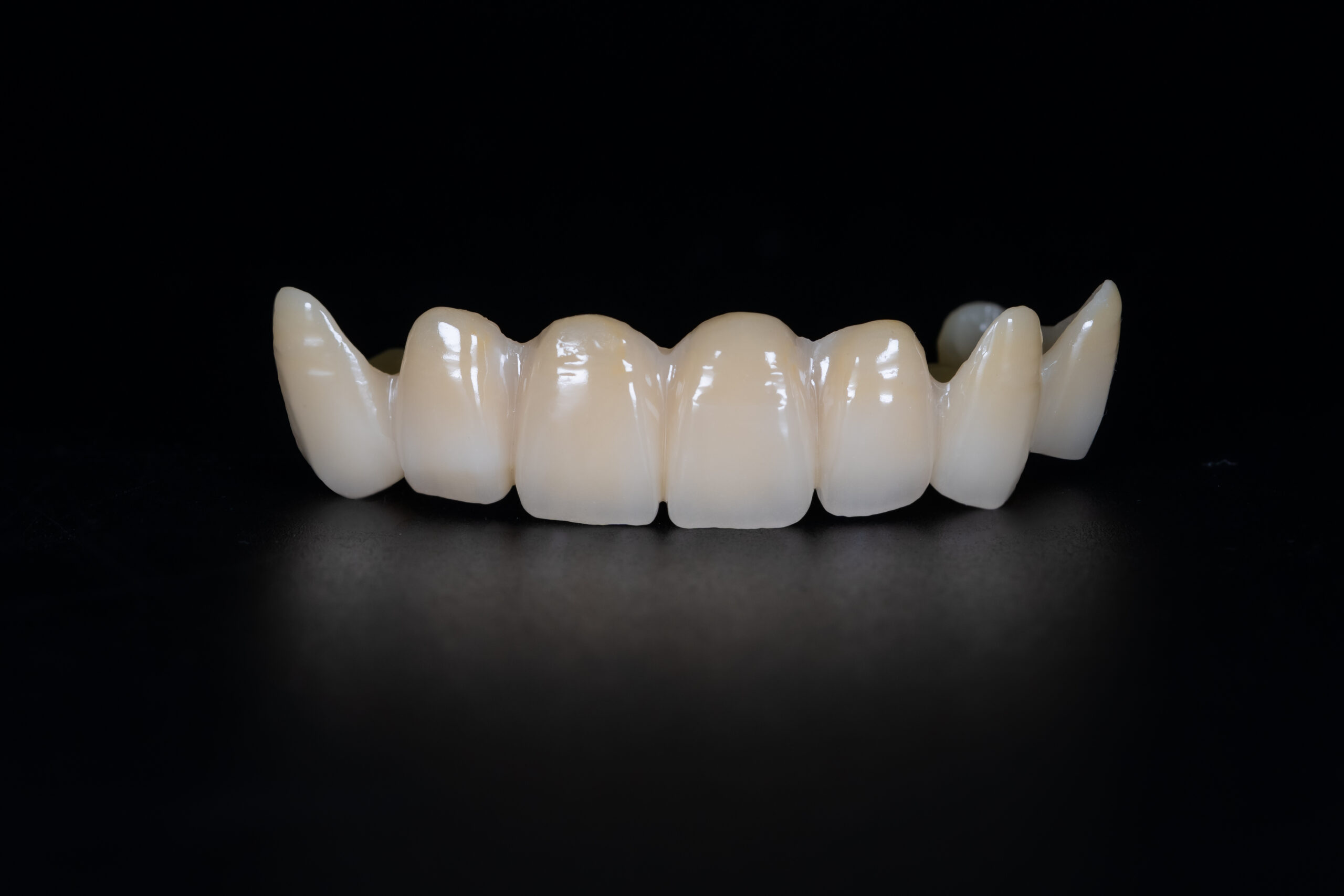 オールセラミック（被せるタイプ）