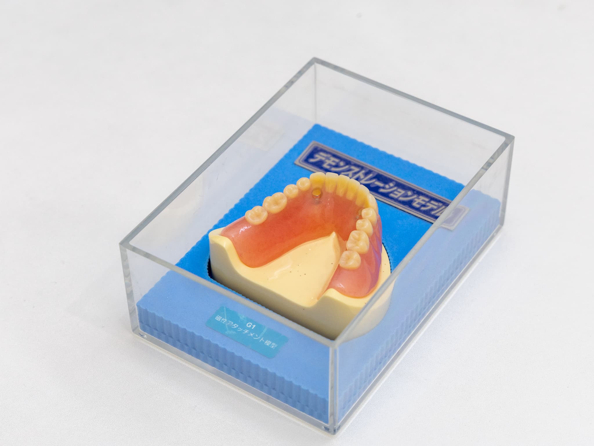 インプラントオーバーデンチャー