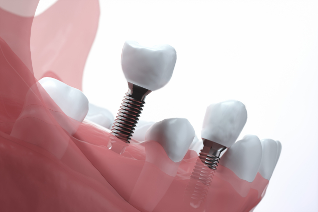 オールオンシックス